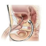 Men’s Prostate Massager - Image 6